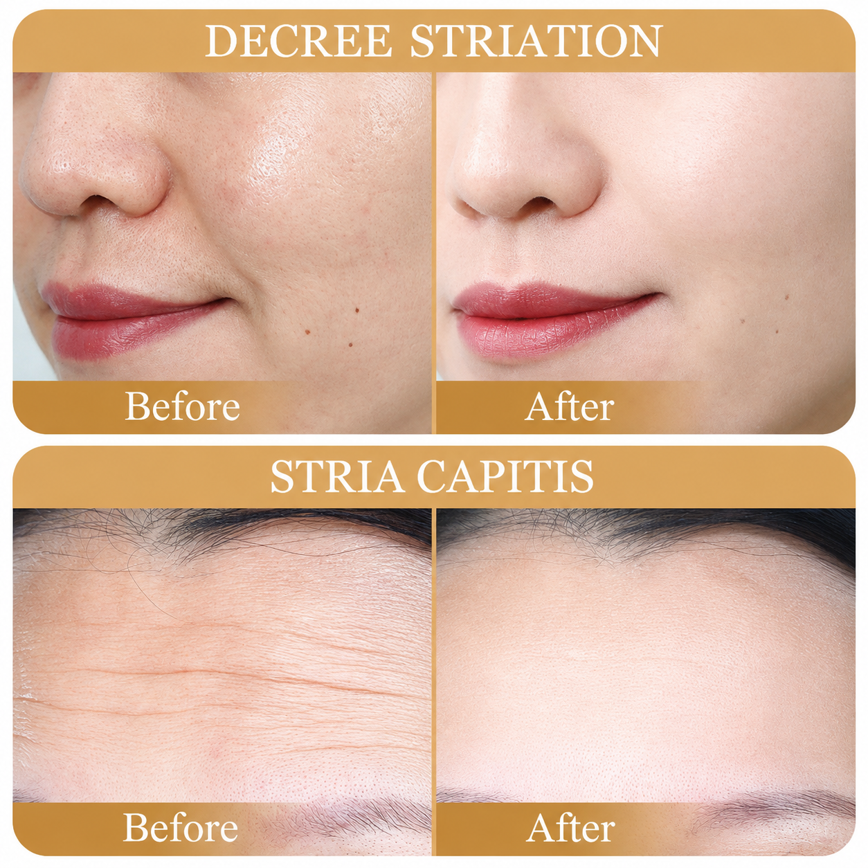 SADOER Collagen Anti-Aging Mask